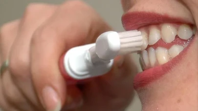 İnternette Satılan Diş Beyazlatma Kitlerine Dikkat! Diş Sağlığınızı Olumsuz Etkileyebilir