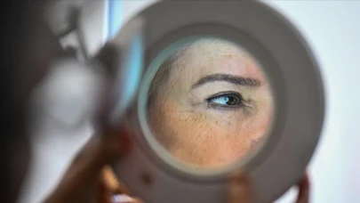 Yüz Lekelerine Dikkat: Sadece Estetik Değil, Sağlık Sorunlarının da Habercisi Olabilir!