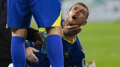 Yaşadığı Sakatlık Nedeniyle Burnu Kırılan Edin Dzeko'nun Son Durumu Ne? Dzeko'nun Sakatlığına Dair Son Gelişmeler