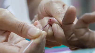 Talasemi Taşıyıcısı Olanlar Çocuk Sahibi Olabilir mi? Akdeniz Anemisi Bulaşıcı mı? İşte Gerçekler!