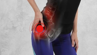 Kalça Ağrınız Geçmiyorsa Dikkat! Bu Hastalıkların Belirtisi Olabilir