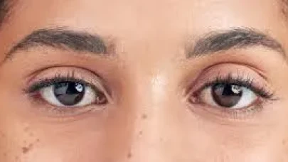 Göz Kapağı Düşüklüğünü Önlemek İçin Göz Egzersizleri ve Doğal Çözümler!