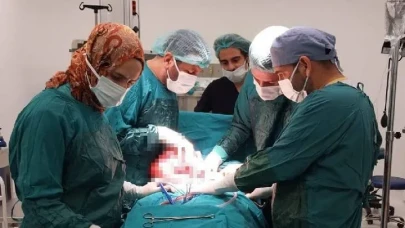 Diyarbakır’da Şaşkına Çeviren Ameliyat: Kadının Karnından Dev Miyom Çıktı!