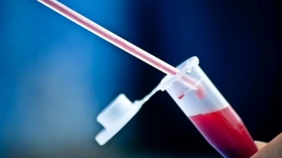 Kan Grubuna Göre Kanser Riski Açıklandı! Siz Hangi Gruptasınız?