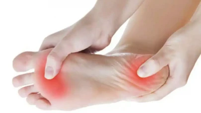 Her Adımda Acı Çekiyorsanız Dikkat! Bu Belirtiler Topuk Dikenine İşaret Ediyor!