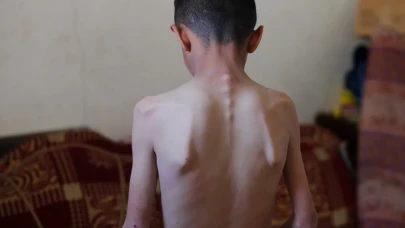 İsrail’in Ablukası Gazze’de İnsani Krizi Derinleştiriyor: Çocuklar Hayatta Kalma Mücadelesi Veriyor
