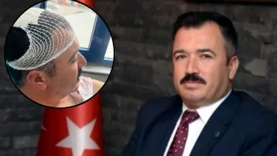 Makamda Skandal Saldırı! Belediye Başkan Yardımcısına Bakır Şekerlikle Saldırdı