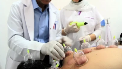 Hacamat Nedir, Faydaları Nelerdir, 2025'te Hangi Günler Yapılır, Noktaları Nelerdir?