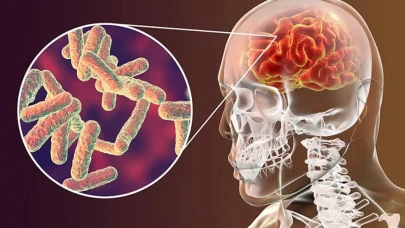 Menenjit Hastalığı Nedir, Nasıl Bulaşır, Belirtileri Nelerdir, Korunma Yolları ve Tedavi Yöntemi Nedir?