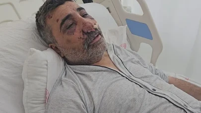 İngiliz Boksör İstanbul’da Tutuklandı! Taksici Kadir Biçer Yaşadıklarını Anlattı