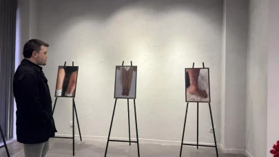 Kayseri’de Yapay Zeka Destekli Romatizma Sergisi Açıldı