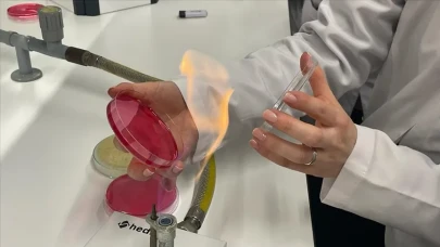 Teknolojik cihazların bozulma sebebi ortaya çıktı: O bakteri cihazların plastiklerini yiyor!