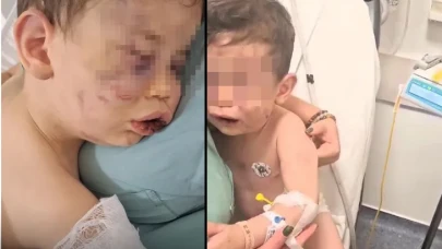 İnsanlık Dışı Şiddet! 2 Yaşındaki Çocuğa Vahşet, Anne Sevgilisini Suçladı