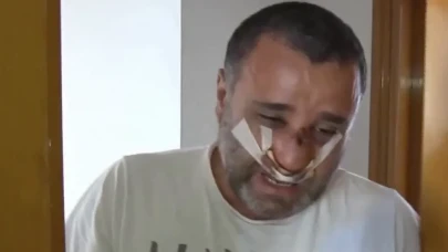 Burnu Kırılan Baba İsyan Etti: Çocuklarımın Yanında Ne Hakkınız Var?