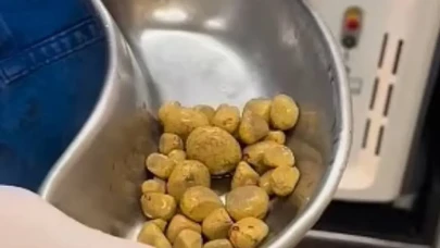 Ürolog Uyardı: Gazlı İçecekler Ameliyatla Bitebilir