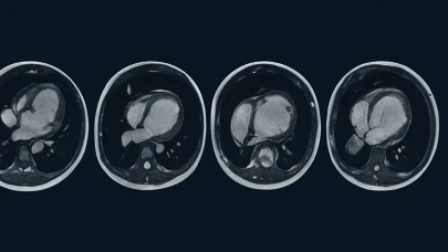 Sessiz tehlikeye karşı MRI umudu