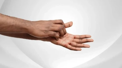 Sol el kaşınıyorsa cebinizi kontrol edin! Uyarı gibi alamet