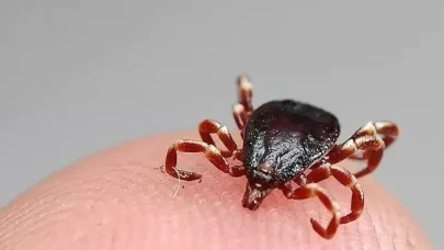 Küçük ısırık, büyük veda: Sivas’ta bir genç daha kenenin kurbanı oldu