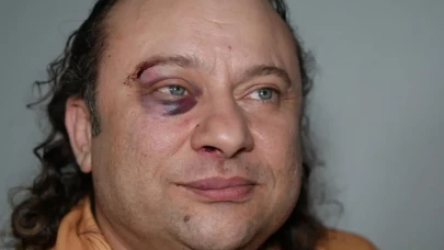 “Bayıldı, kalp kriziymiş!” Ünlü ses sanatçısından korkutan haber