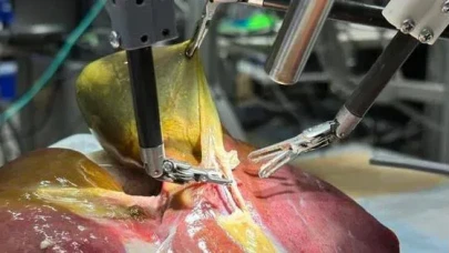 Robotik cerrahide devrim: İlk kez bir ameliyatı tamamen otonom bir robot gerçekleştirdi