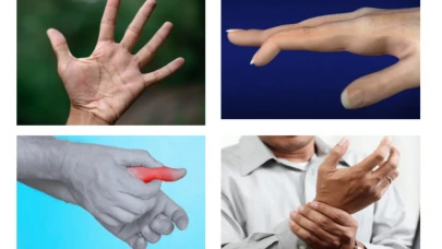 Elleriniz uyuşuyorsa dikkat! Altında yatan neden ciddi olabilir