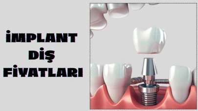 İmplant Diş Fiyatları 2025 Yılında Ne Kadar Oldu? Tedavi ve Maliyet