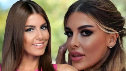 Tuğçe Özbudak kimdir, aslen nereli, kaç yaşında, estetik mi, boyu ve kilosu? Operasyonların ardından son hali