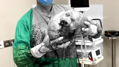 70 yaşındaki kadının yaşamını değiştiren ameliyat