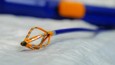 Kalp ritim sorunlarına yan etkisiz tedavi: PFA yöntemi umut veriyor