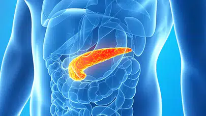 İspanya’da pankreas kanseri nasıl tedavi edildi? Pankreas tümörünü yok etti mi?