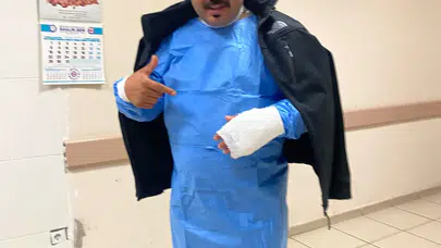 Fizik kuralları soğuk havaya galip geldi: Sosyal medyadan esinlendi, kendini yaktı!