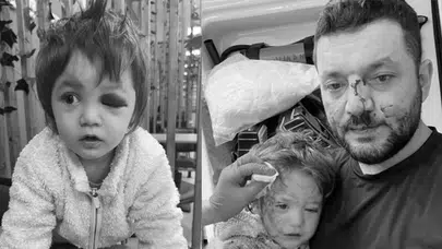 Yalova Çınarcık’ta Baba ve Bebeğe Acımasız Saldırı