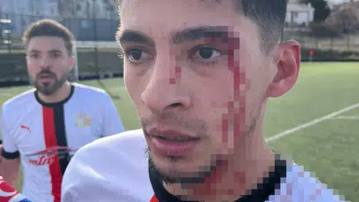 Maç bitti, saha karıştı! Gülümbespor futbolcuları hastanelik oldu