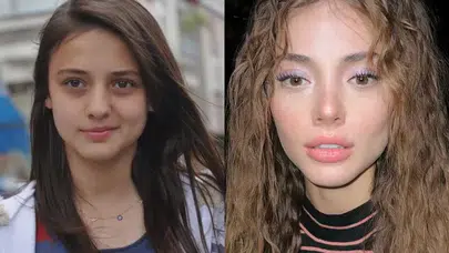 Rabia Soytürk estetikli mi?