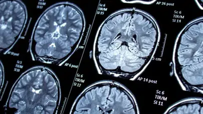 Uzmanlardan Kritik Uyarı: Bu Hastalar Oruç Tutarak Risk Alıyor!