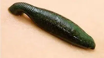 Sülük Ne İşe Yarar,  Faydaları Nelerdir, Hangi Hastalıklara İyi Gelir?