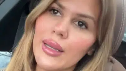 Boşanma Sonrası Radikal Karar! Gülseren Ceylan Dolgularını Eritti