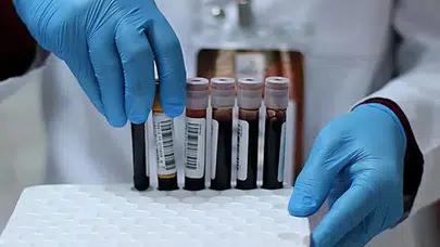 50 Bin Kişilik Araştırma Sonucu Şaşırttı: Kan Grubu Sağlığı Etkiliyor!