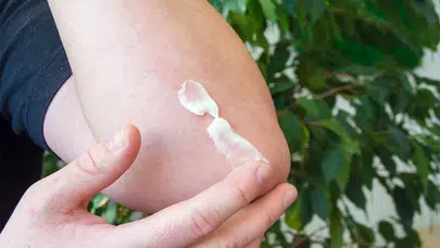 Thiocilline kullananların dikkat ettiği 5 kritik nokta