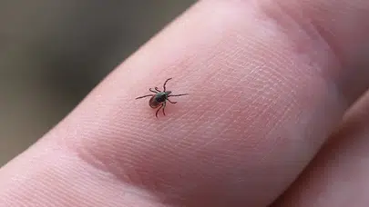 Kene Isırığı Sonrası Kırmızı Et Yedi, Hayatını Kaybetti! Dünyada İkinci Vaka