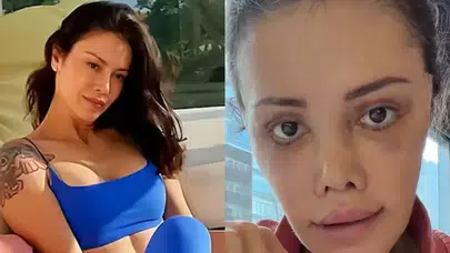 Didem Ceran’ın Son Hali Olay Oldu! “Yüz Nakli Mi Yaptırdı?” Sorusu Gündemde