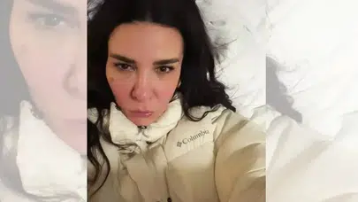 Fatma Turgut’un yüzündeki değişim gündem oldu!