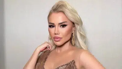 Ceylan estetiğe veda etti! Yüzü artık estetiği kabul etmiyor