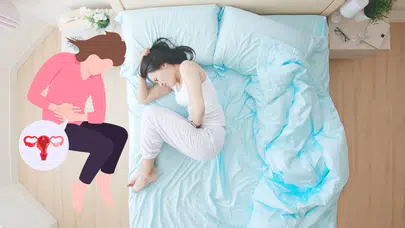 Rahimde İltihap Nedir, Belirtileri Nelerdir, Neden Olur ve Nasıl Tedavi Edilir?