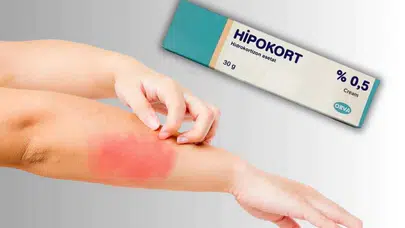 Cildiniz alarm veriyorsa... Yan etkileri göz ardı etmeyin!