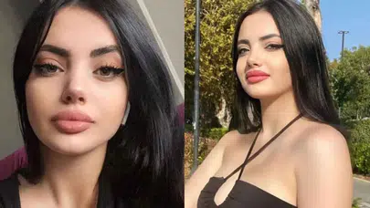 Estetik İddiaları Gündemde: Elif Nerelerine Müdahale Yaptırdı?