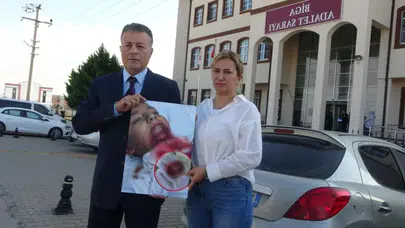 7 Yaşındaki Kuzey’in Yüzü Parçalanmıştı! Bilirkişi Konuştu: “Ağır Özensizlik” Tespiti