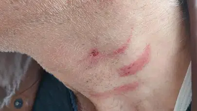 Konya’da Aile Hekimine Saldırı Olayı Nedir, Muayene Sırası Tartışması Sonrası Müezzin Yusuf Mete Neden Tutuklandı?