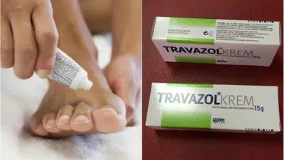 Travazol krem; mantar, pişik, kaşıntı, egzama ve iltihaplı cilt problemlerinde etkilidir