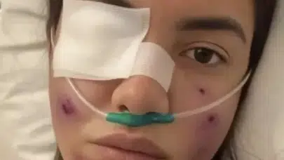 Fulya Öztürk’e 'Geçmiş Olsun' Mesajları Yağdı… İşin Aslı Bambaşka Çıktı